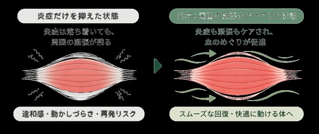 炎症だけを抑えても周囲の緊張が残ると違和感や再発リスクにつながる、炎症+緊張までケアすると血のめぐりが促進され快適に動ける体になる図解