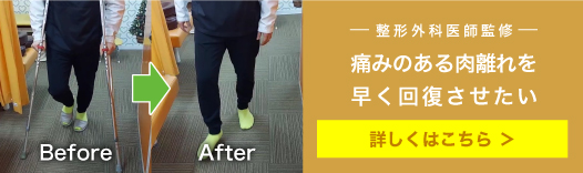 【整形外科医師監修】痛みのある肉離れを早く回復させたい。