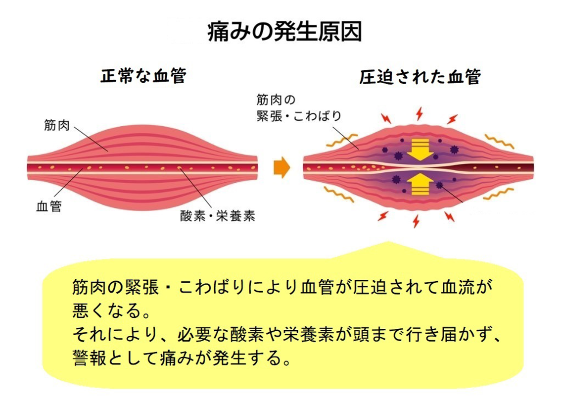 痛みの発生原因