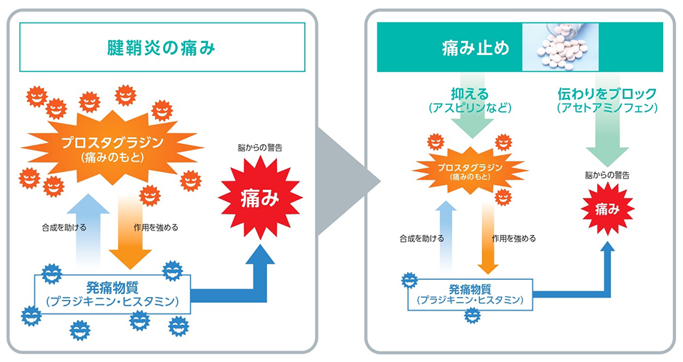 痛み止めの仕組み